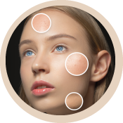 addressing-skin-concerns
