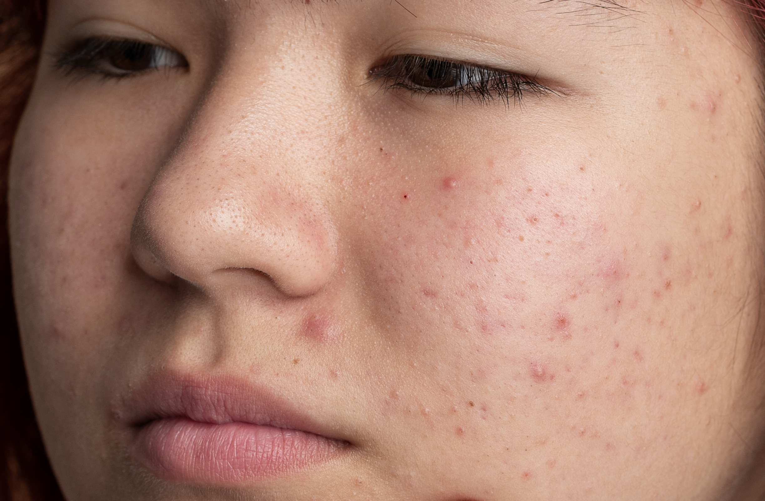 close-up-skin-pores-face-care-routine