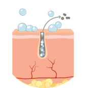 helps-unclog-pores
