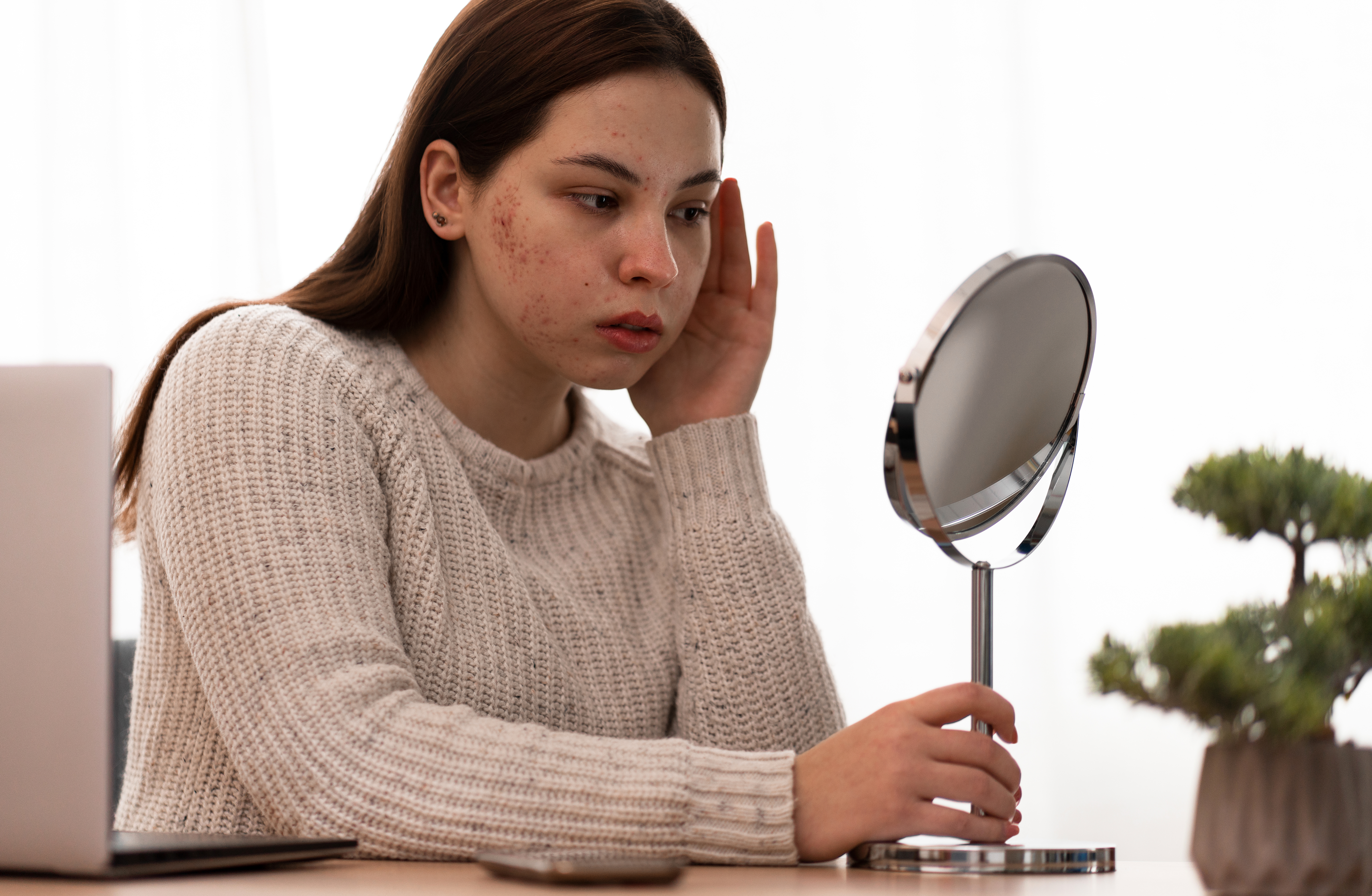 person-dealing-with-rosacea (1)