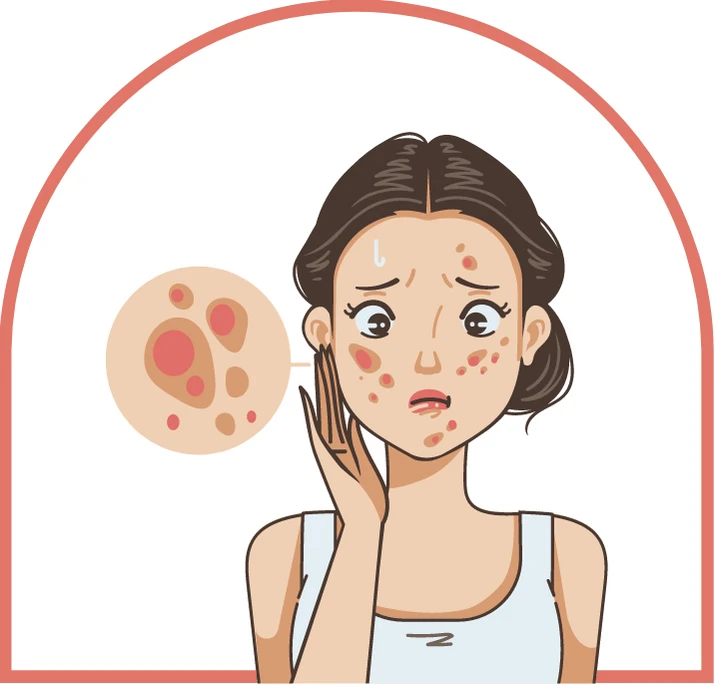 sheet-mask-for-dry-skin